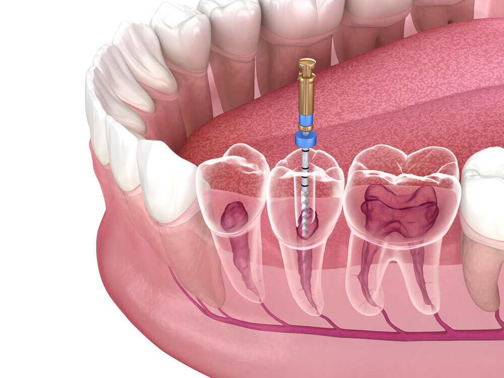 Cosmetic Dentistry